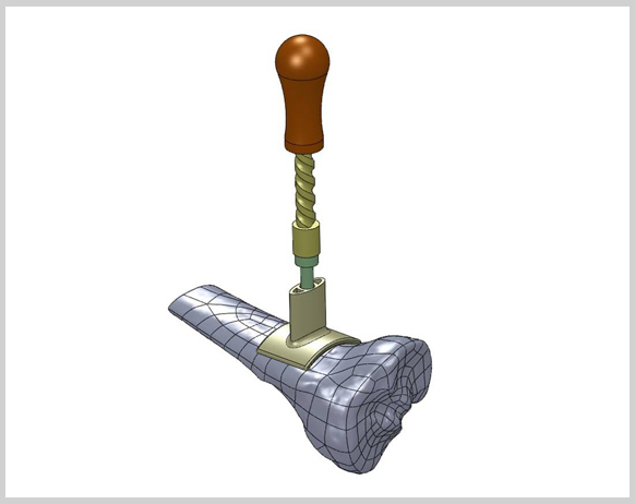 bone-drill
