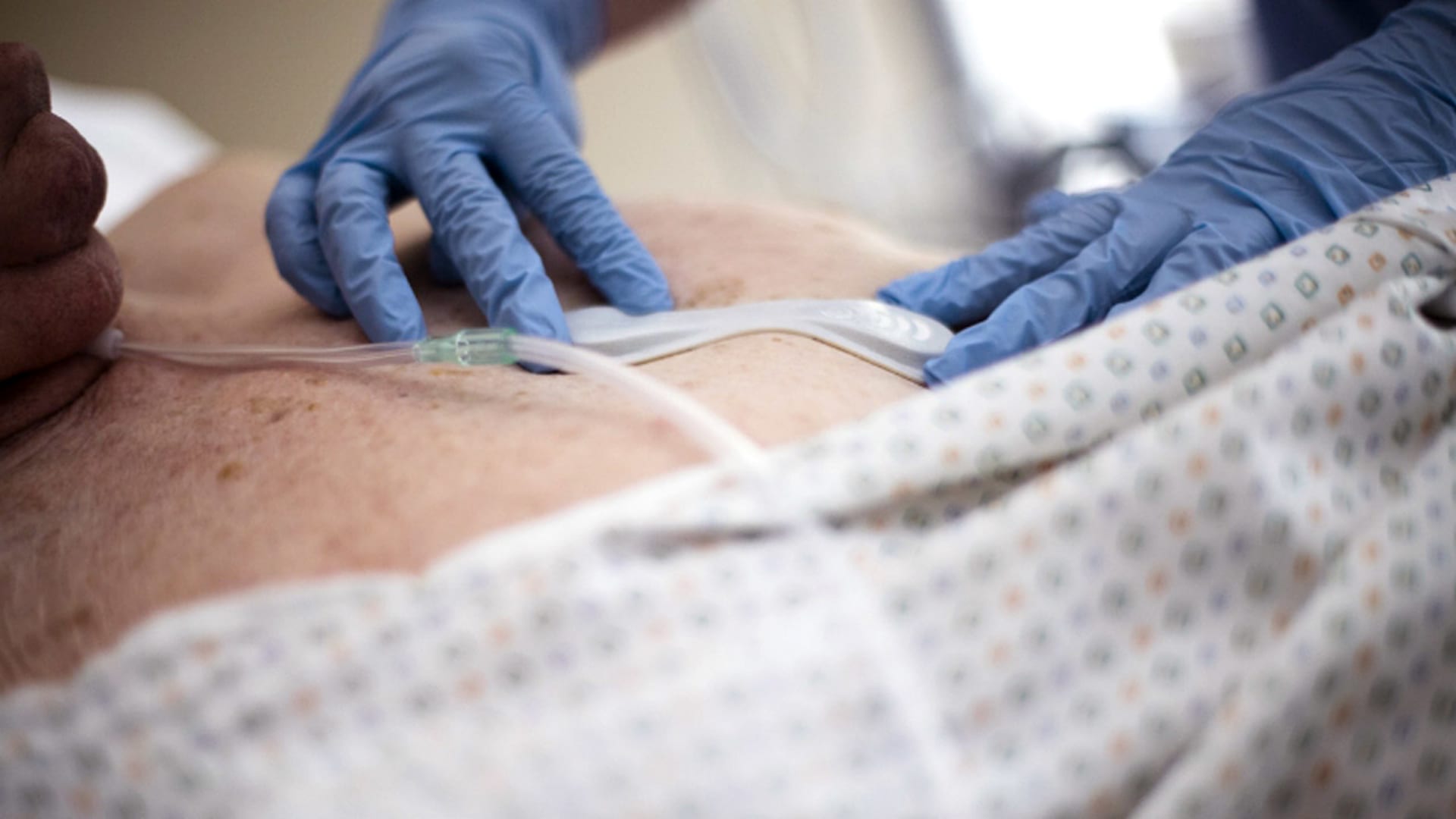 This Little Patch Can Save Patients From Impending Heart Attacks
