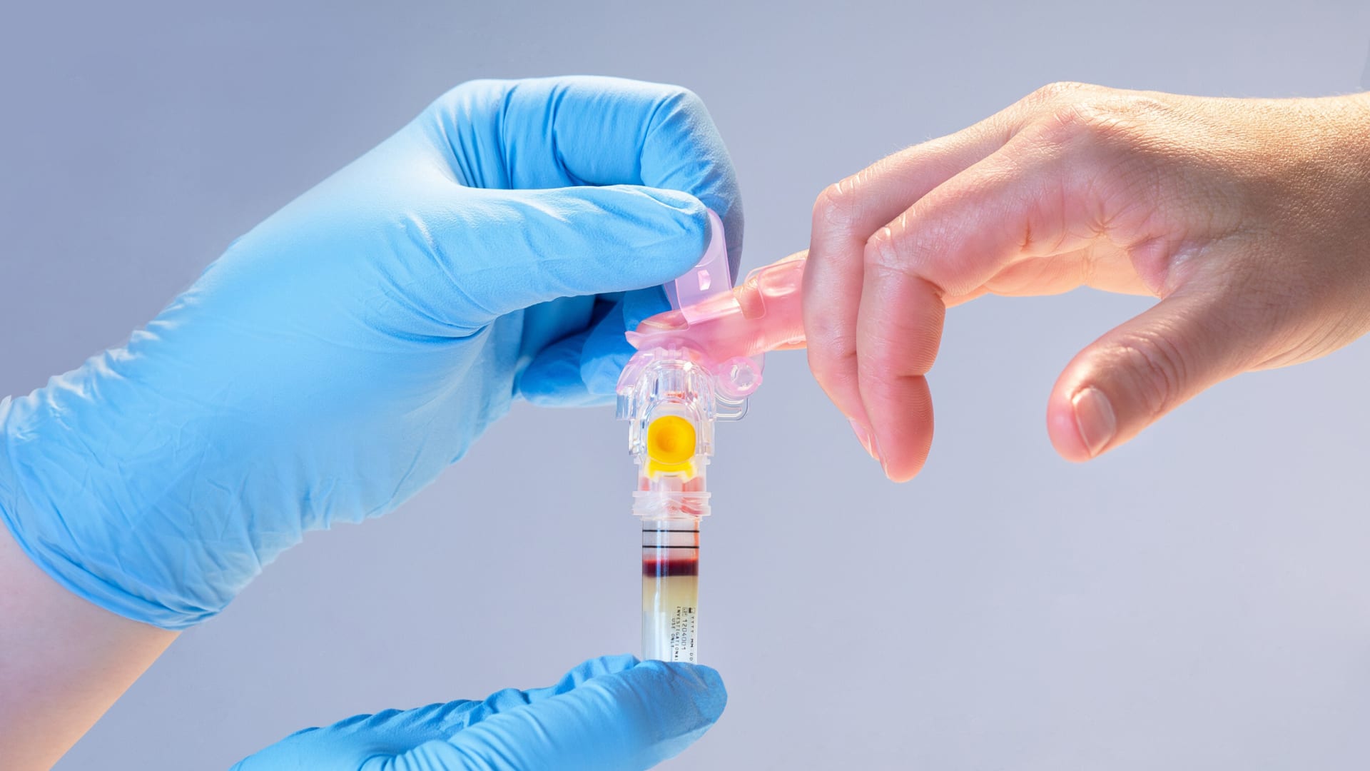 Behind an innovative new blood test that, unlike Theranos, is real