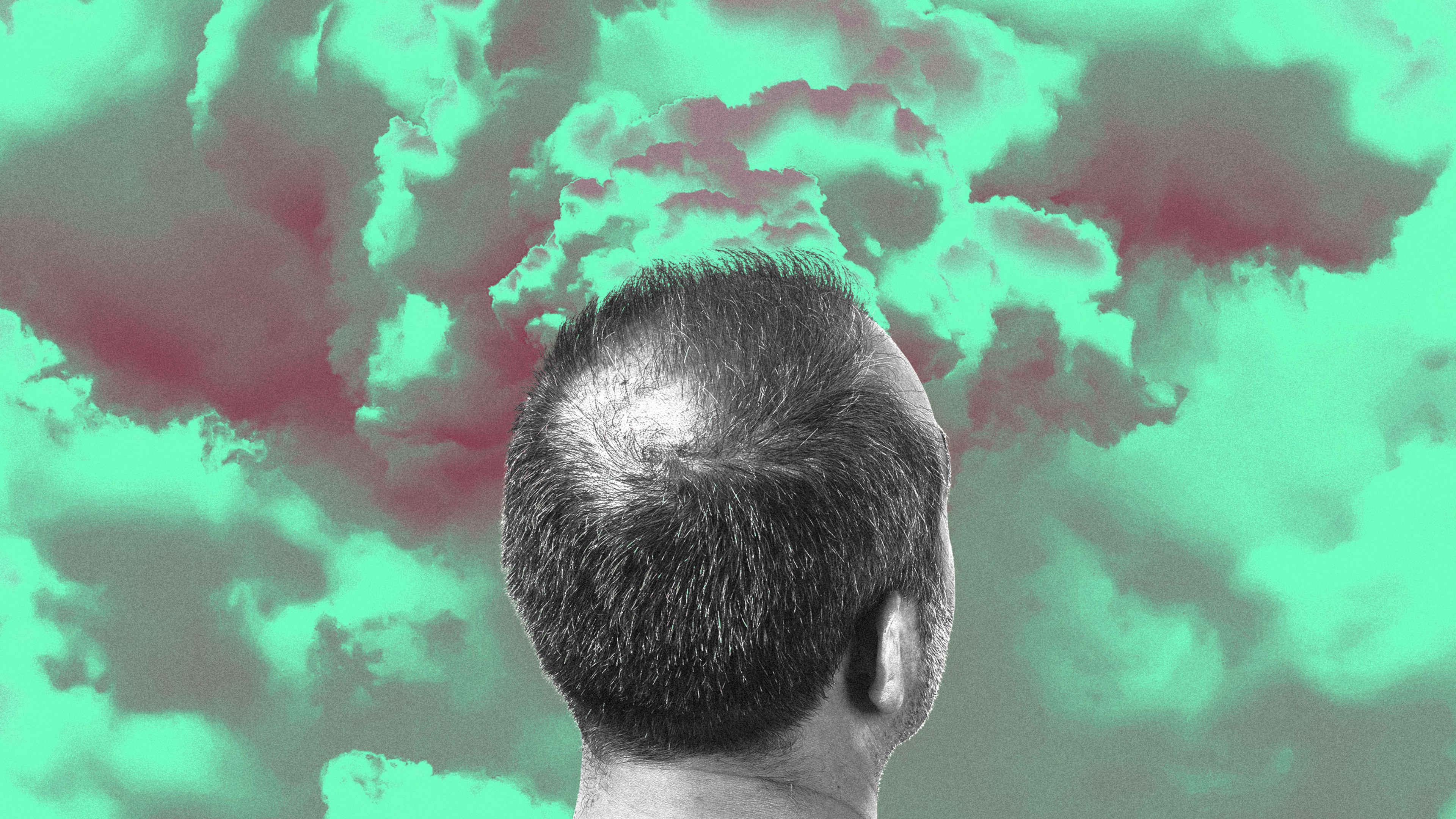 Air pollution might be why you’re going bald
