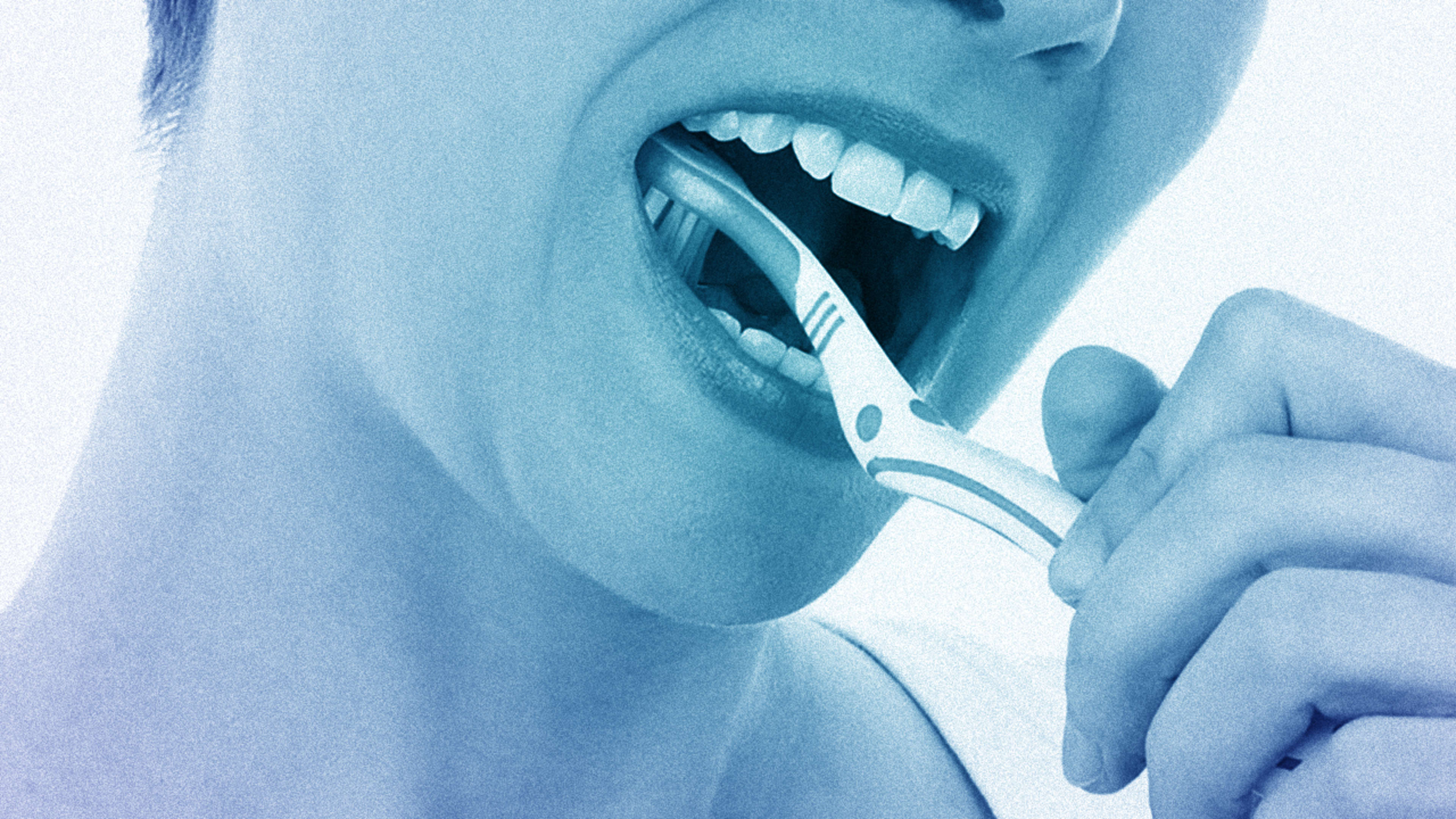 You’re not brushing your teeth enough. Three times a day keeps the heart attack away