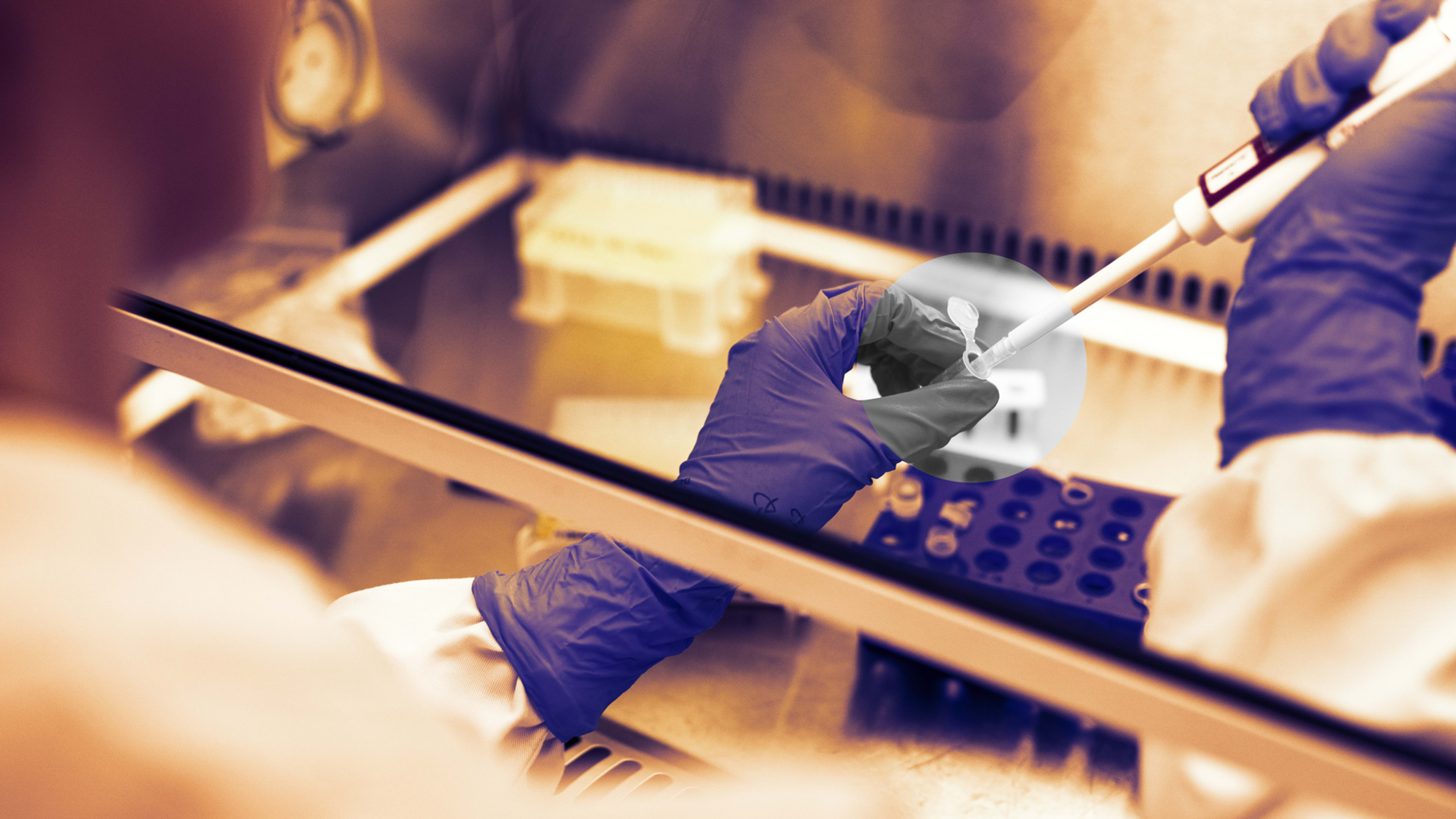 Moderna's encouraging vaccine trial What we know and why the biggest