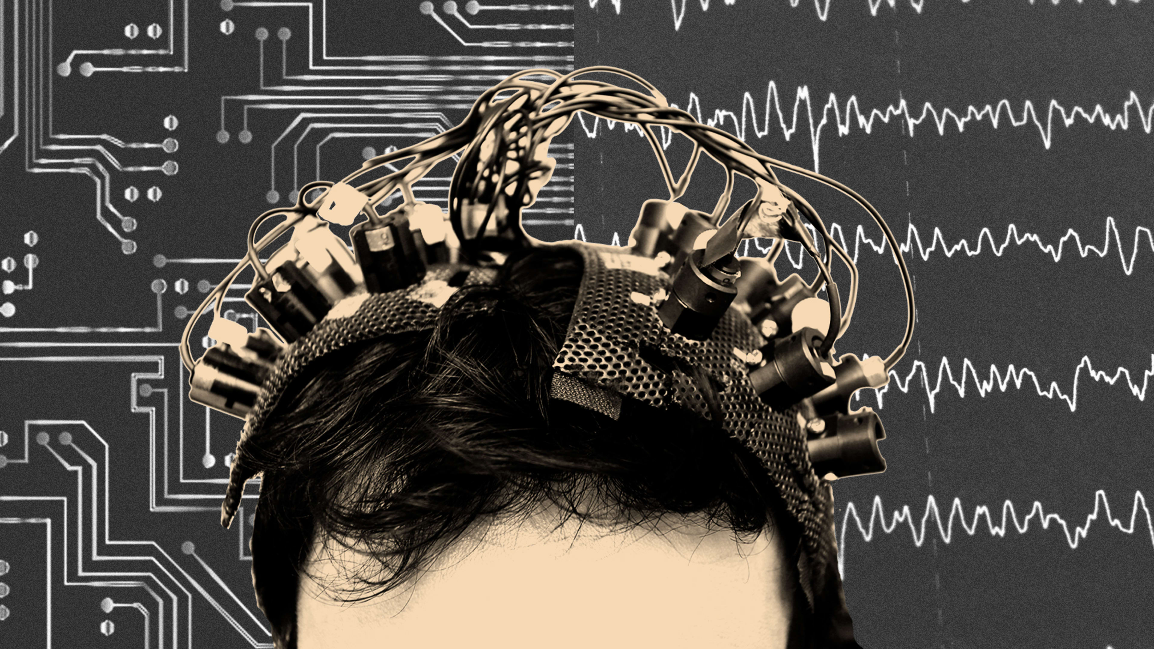Brain-computer interfaces could change the world—but at what cost?