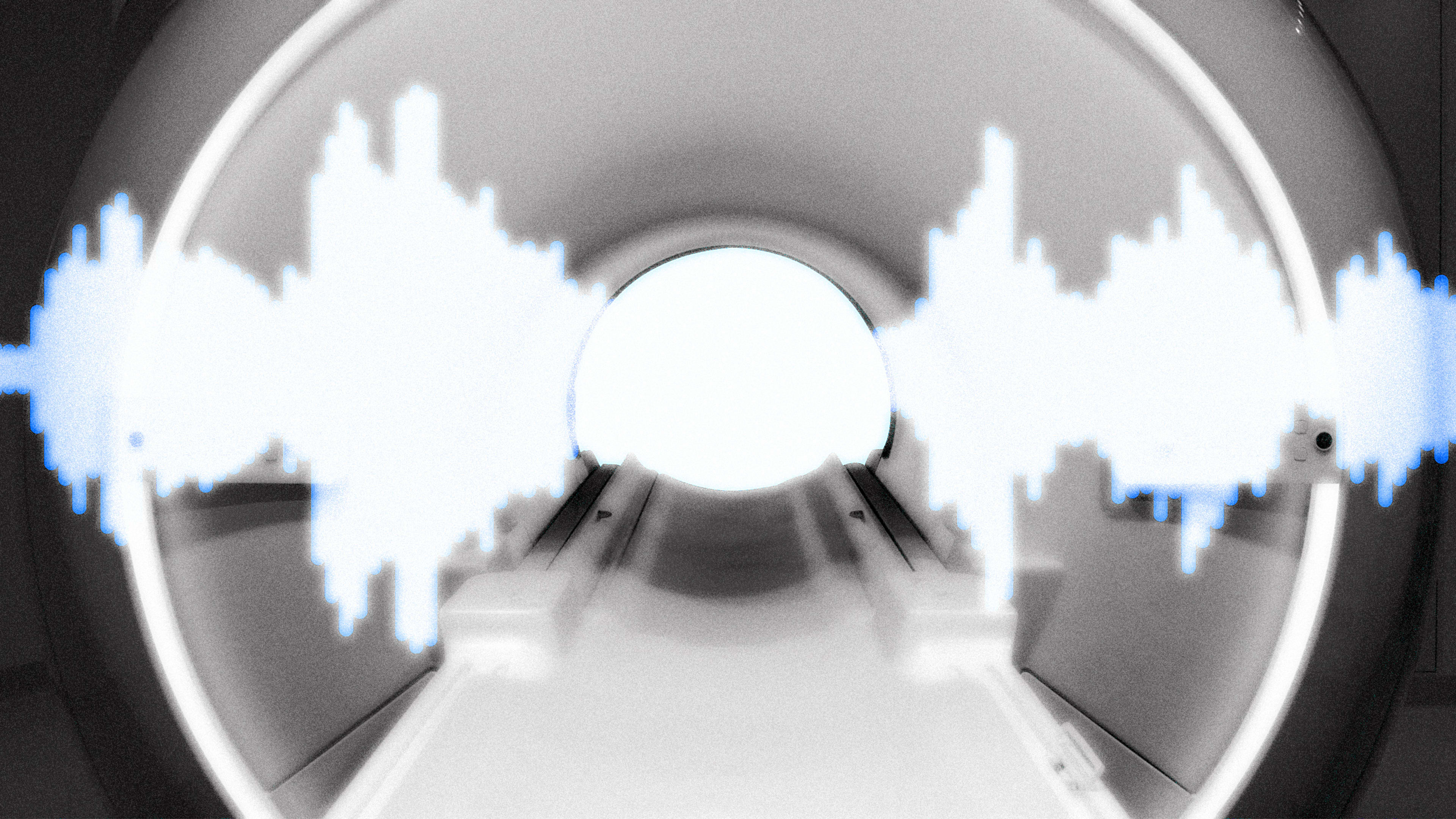 Prenuvo is bringing AI music to MRIs. Can it cure your claustrophobia?