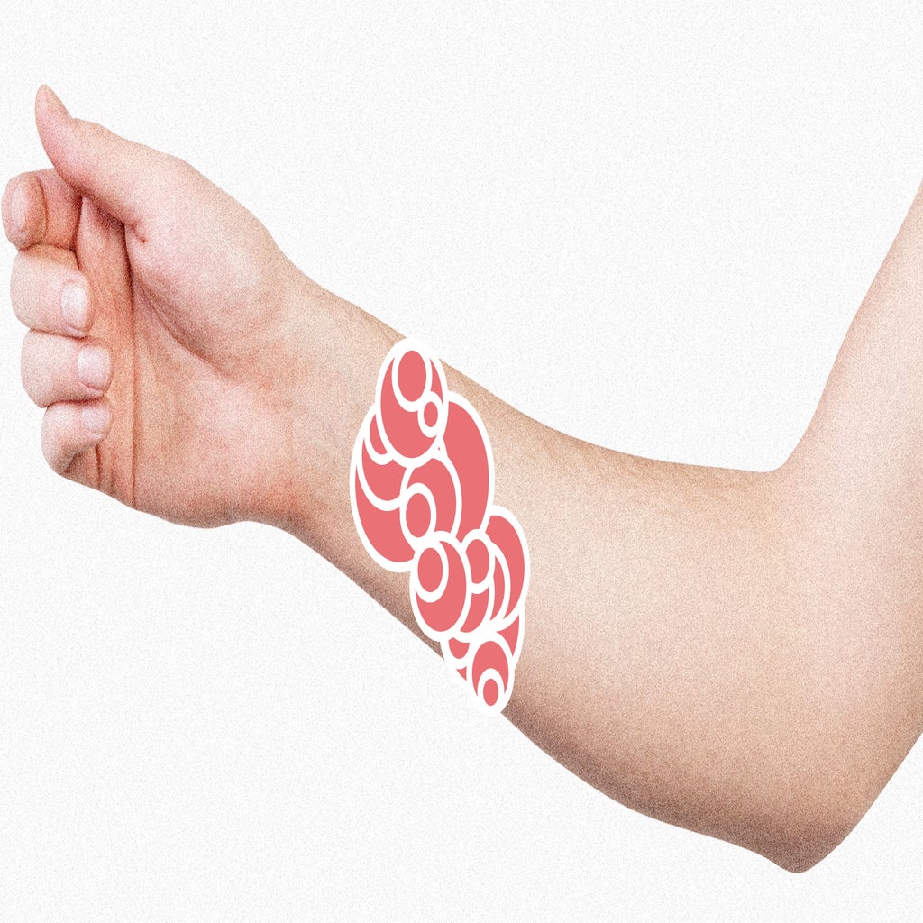 Scariest Rash A Way To Share That Scary Rash With Your Doctor When It Appears At 3 A ...