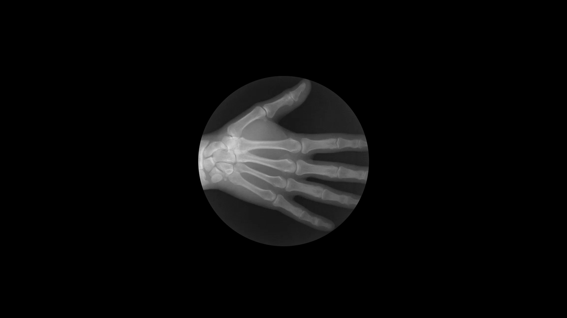 These X-Ray GIFs Will Get Under Your Skin - Fast Company