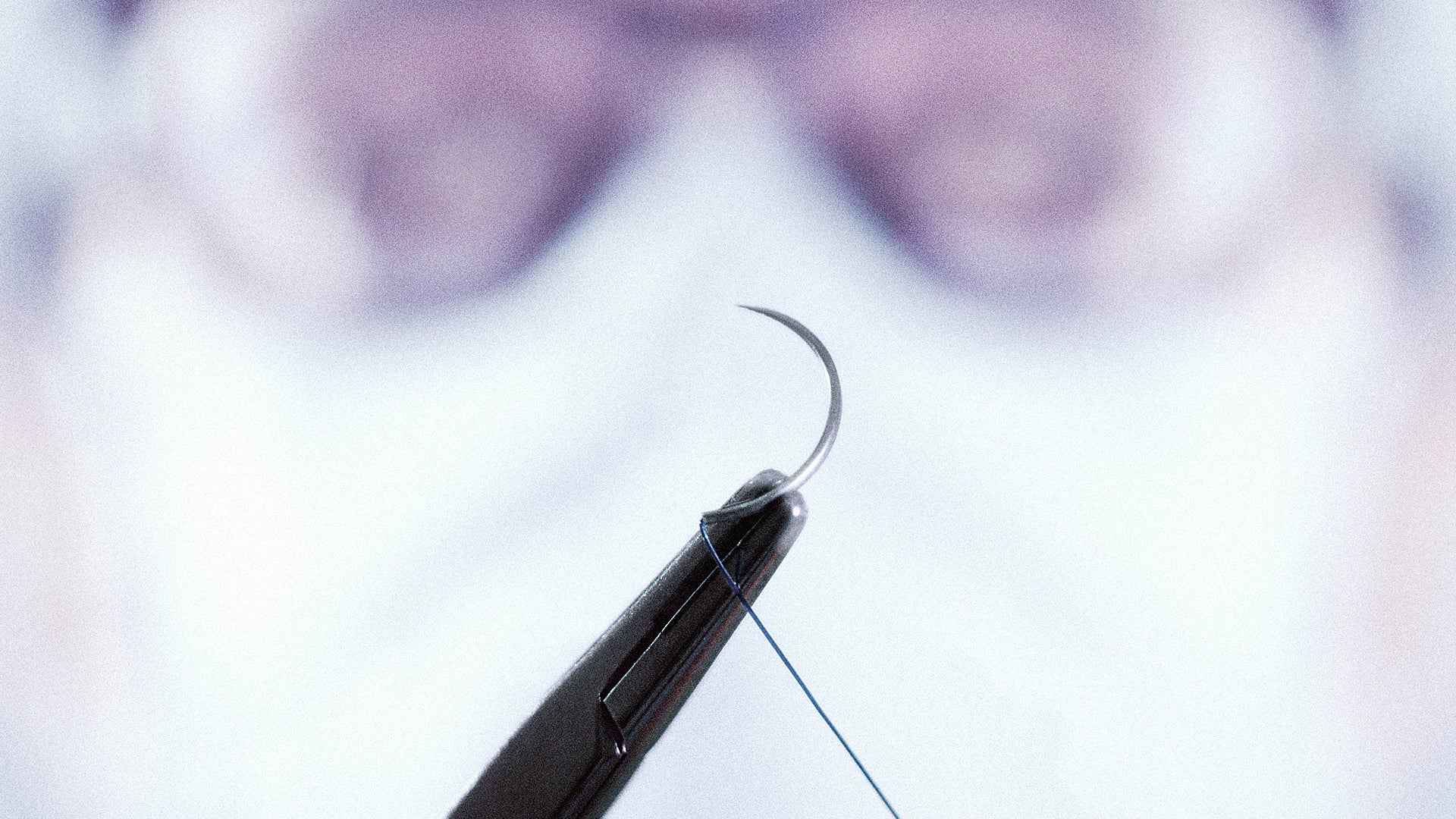 Medical Threading This Smart Surgical Thread Collects Data As Wounds Are Healing - Fast ...