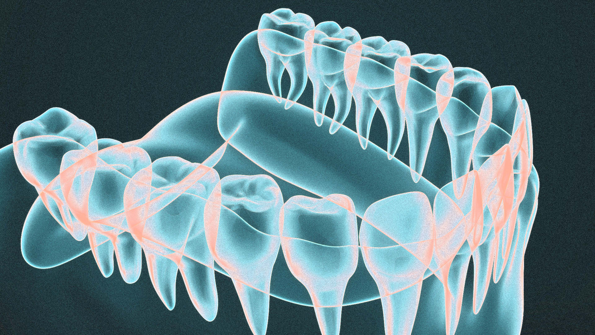 Inmates in Texas could soon get 3D-printed dentures - Fast Company