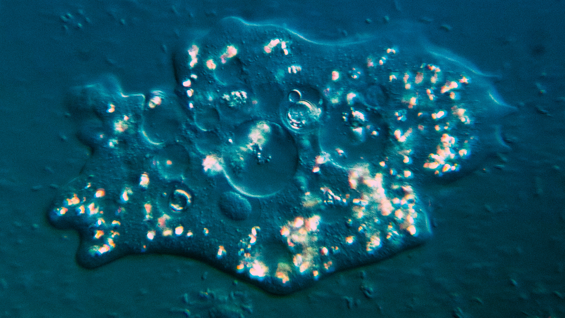 Doctors warn tap water from neti pots can be fatal after braineating