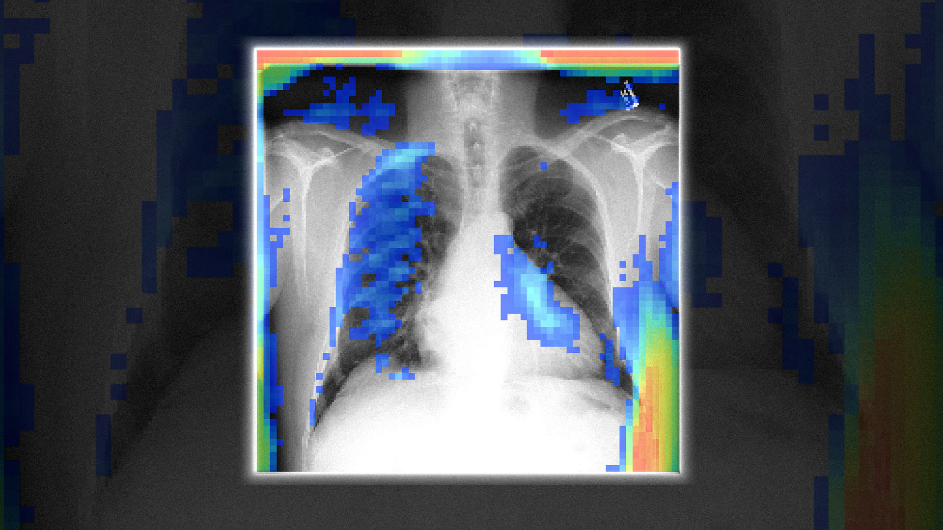 This free AI reads X-rays as well as doctors