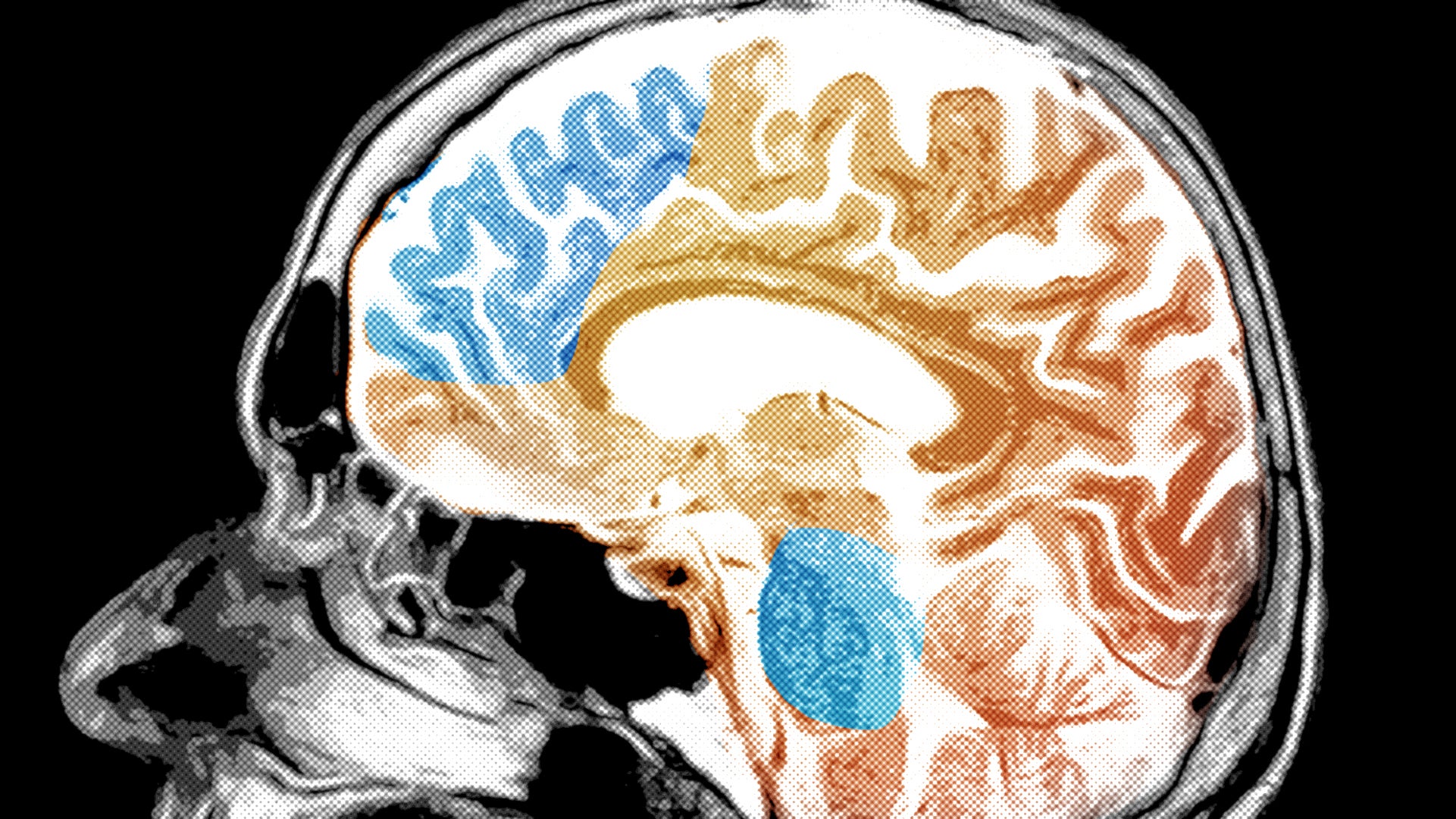 Duke University researchers say every brain activity study you've ever ...