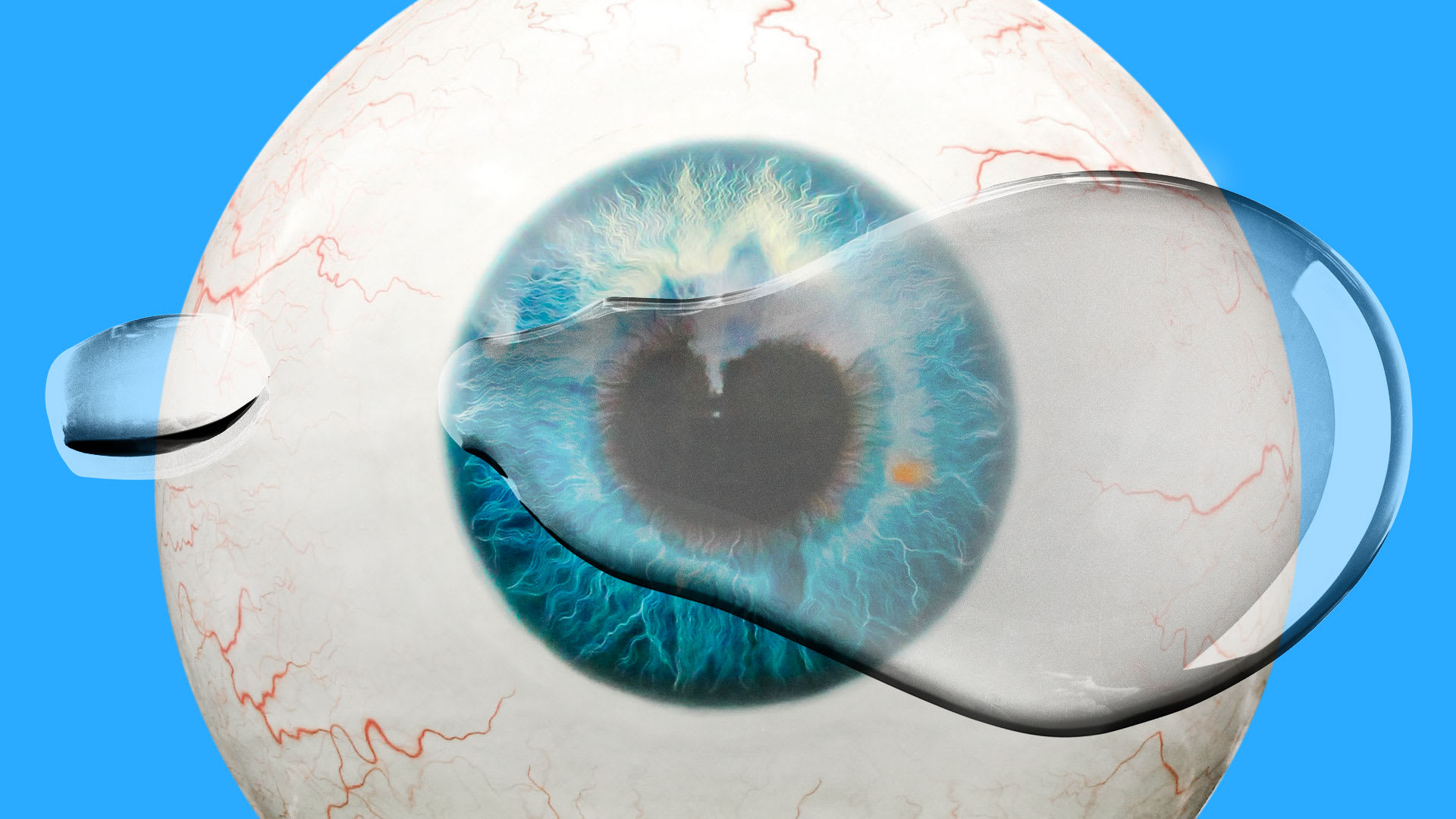 Eye drop recall update Walmart pulls Equate Hydration, issues warning