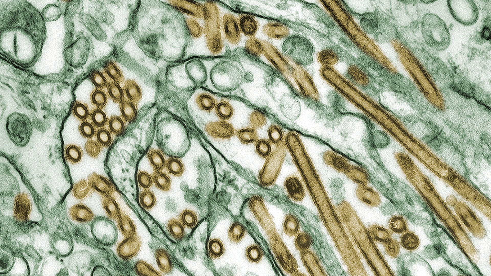 CDC bird flu update What to know after a rare human infection of H5N1