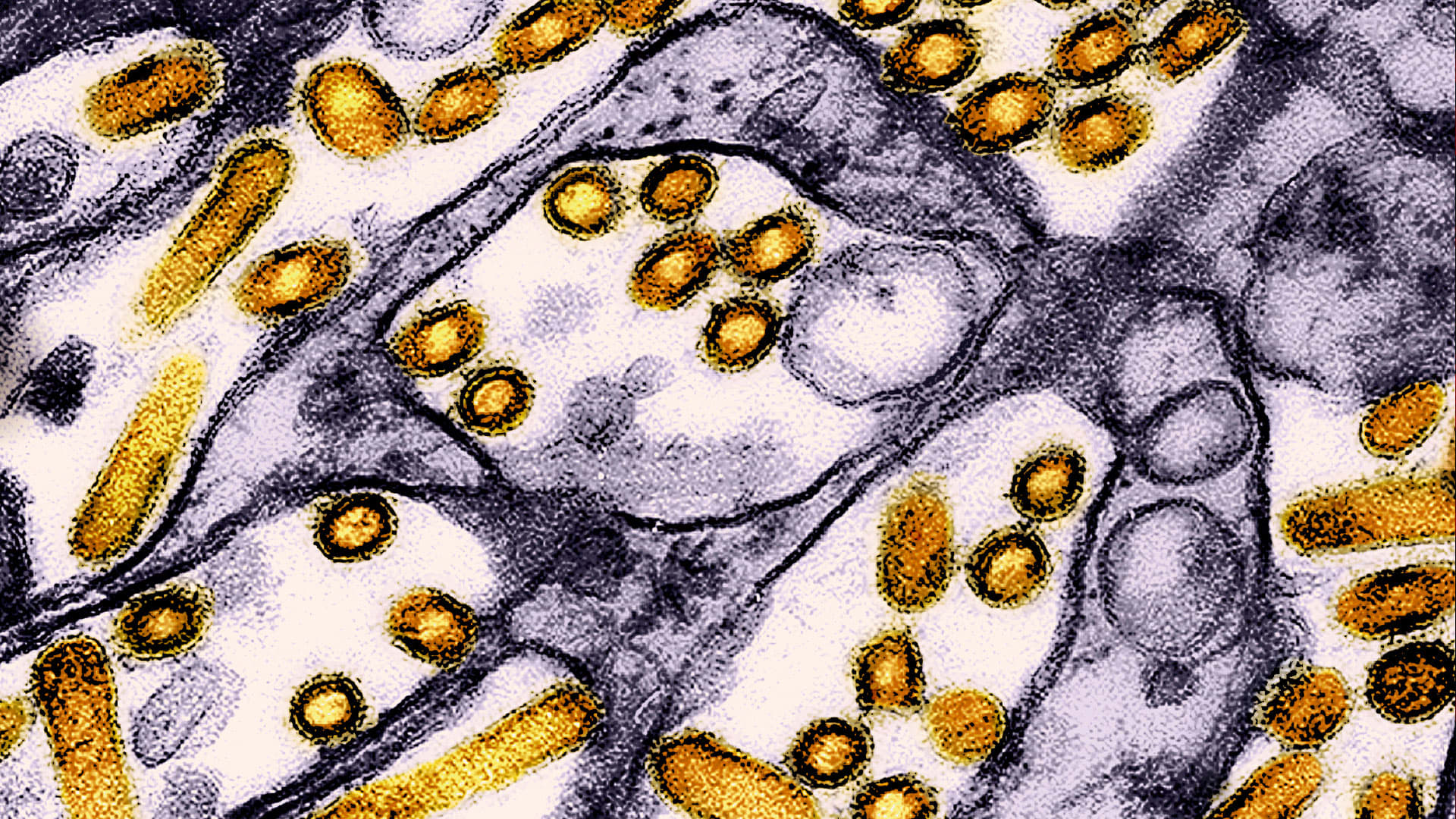 H5N1 bird flu outbreak 2024 symptoms in humans, map, update Fast Company