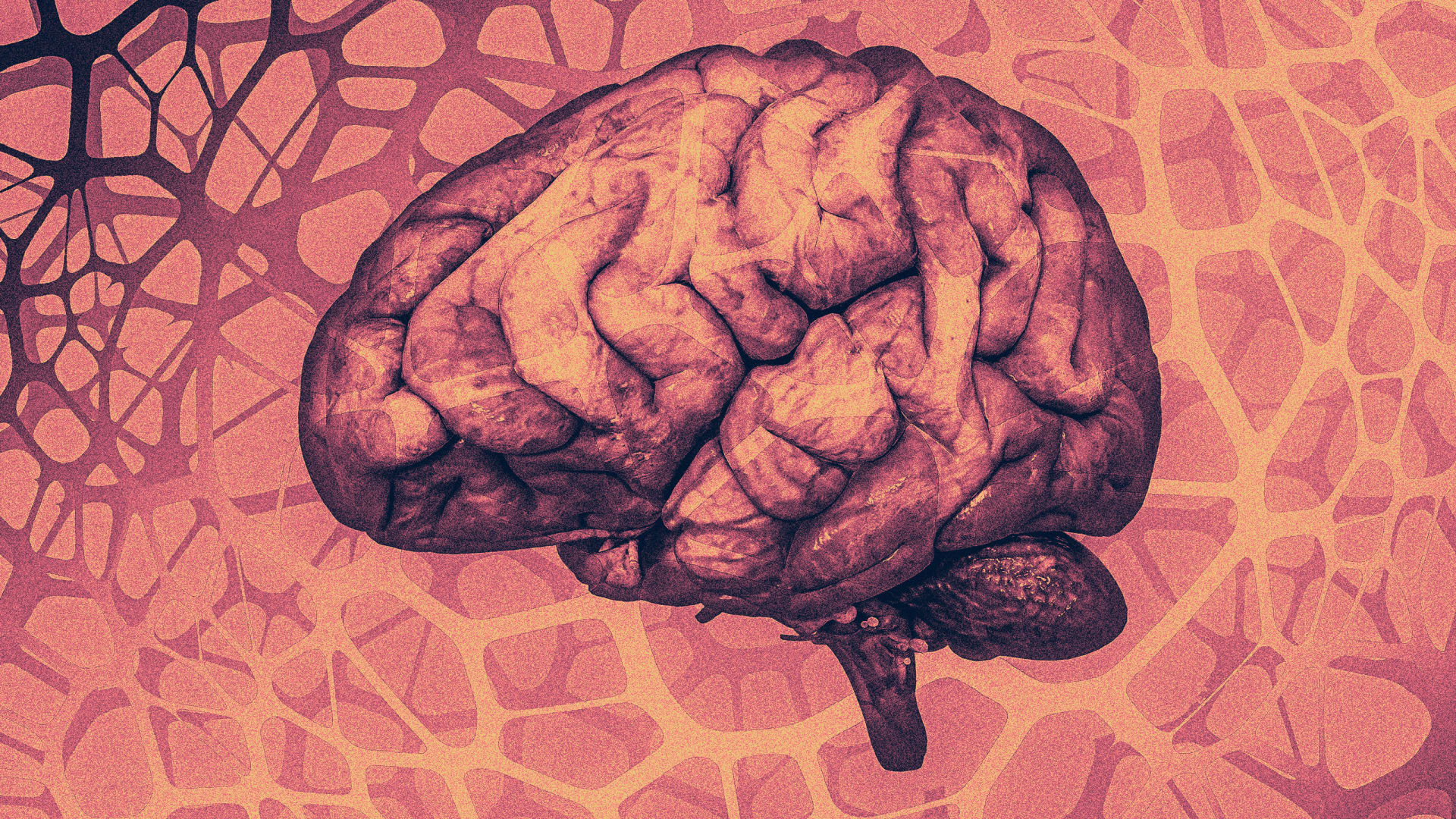 Neurotechnology could revolutionize work—but it comes with big risks for workers