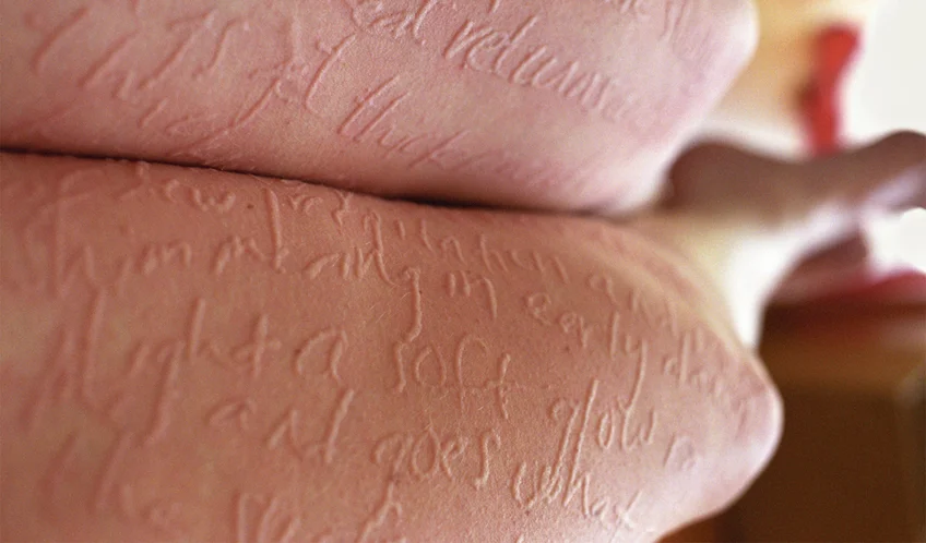 Artist Uses Her Own Skin As A Canvas, Turning A Disease Into Art - Fast ...