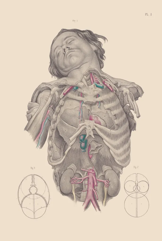 The Morbid History Of Victorian Surgery, Beautifully Illustrated - Fast ...