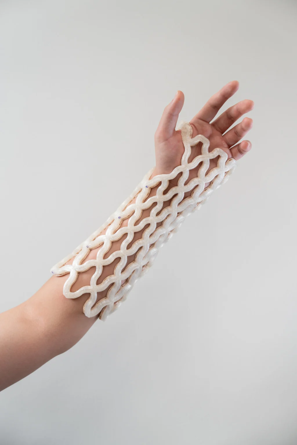 01-91537195-3d-printed-cast.jpg