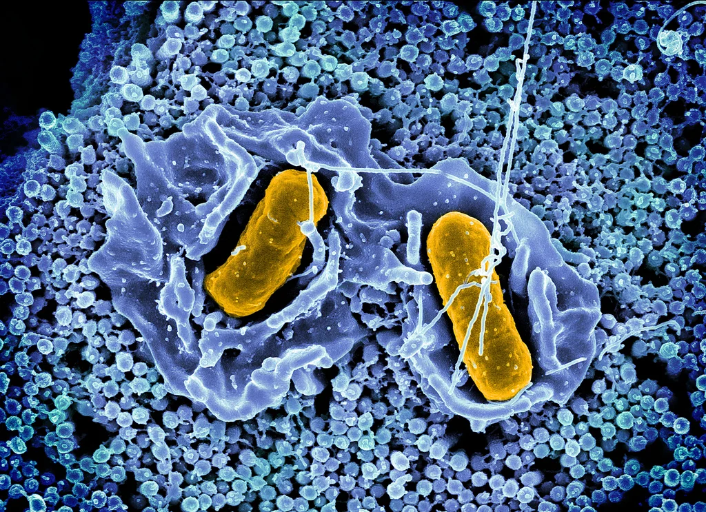 Waarom zijn er zoveel uitbraken van Salmonella? Vier redenen voor de non-stop terugroepacties van voedsel, ziektes en veiligheidswaarschuwingen dit jaar