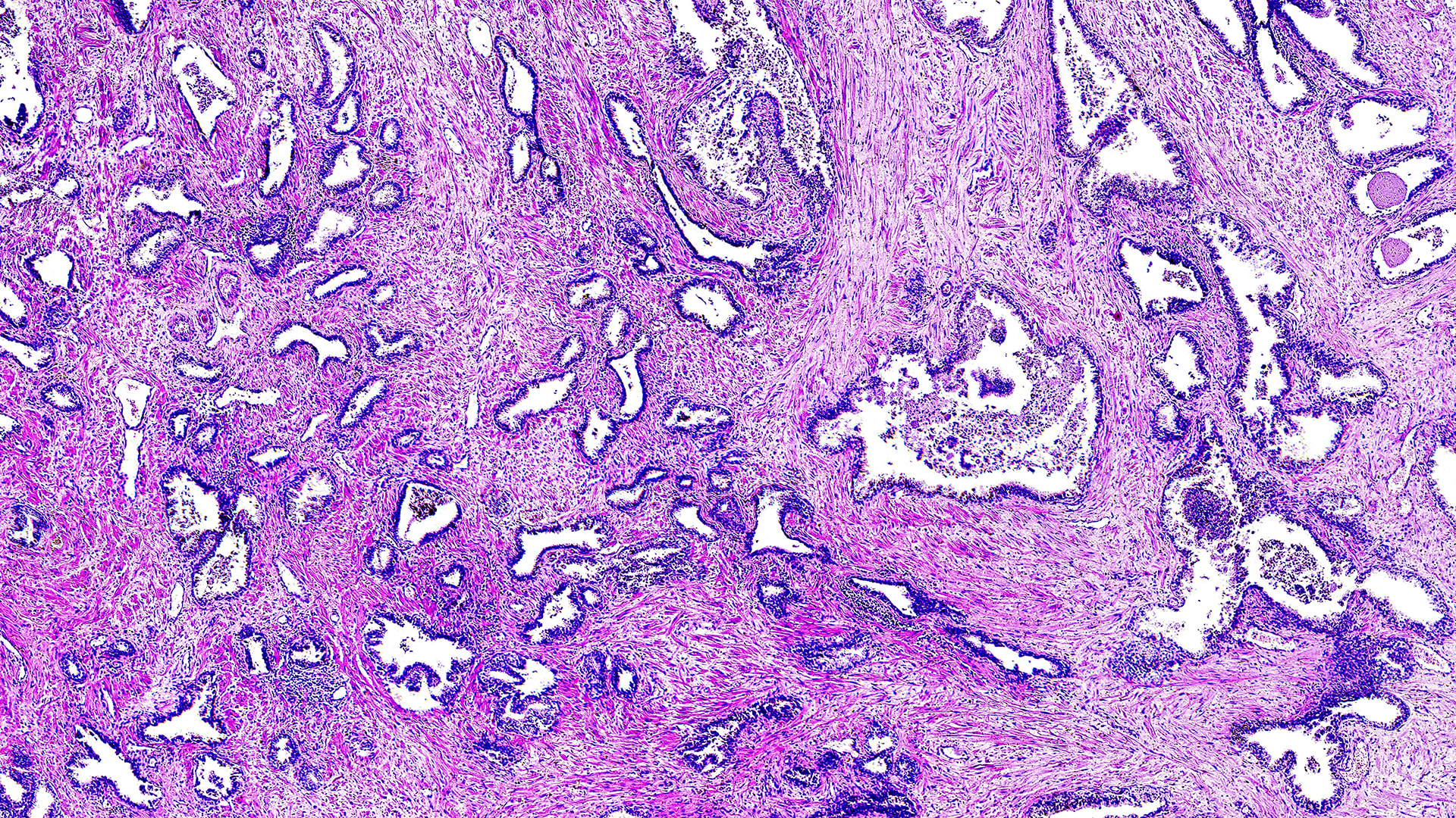 Gabriel otte (84) 사진