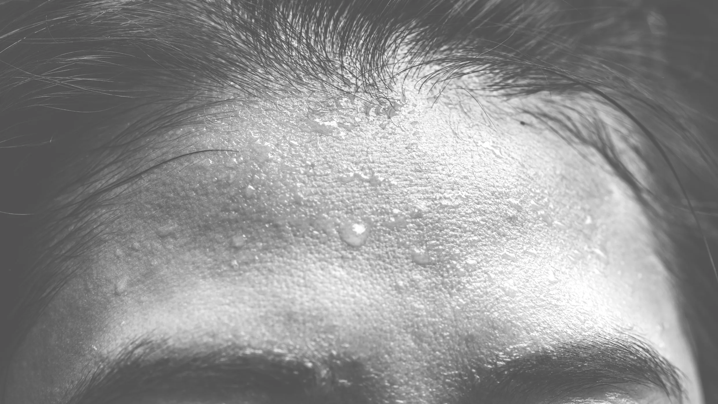 Social media might be making you sweat-literally