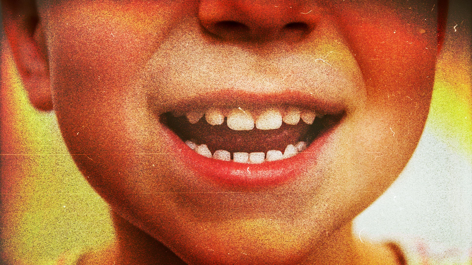 Scientists say they found a way to stop cavities—without drilling