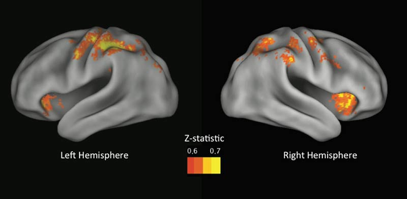 What Your Brain Looks Like Right Before It Takes A Risk - Fast Company
