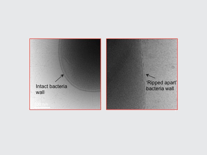 If Antibiotics Fail, We Could Turn To This Entirely New Method To Kill ...