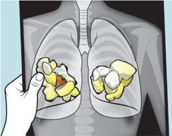 Popcorn Infection Popcorn, Indiana's Kernels Of The Future Are Hot, Prepopped, And Good ...