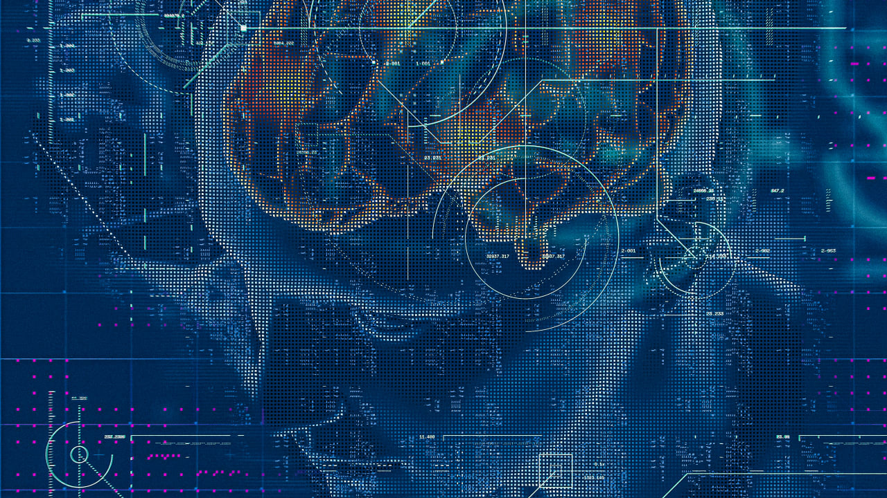 How AI brain mapping can improve disease detection