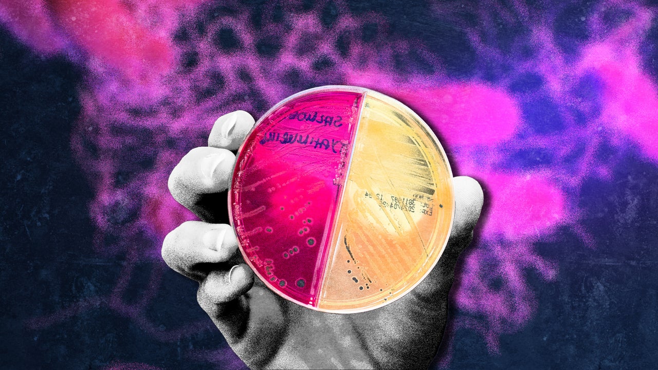 Why are there so many Salmonella outbreaks? 4 reasons for the nonstop food recalls, sicknesses, and safety warnings this year