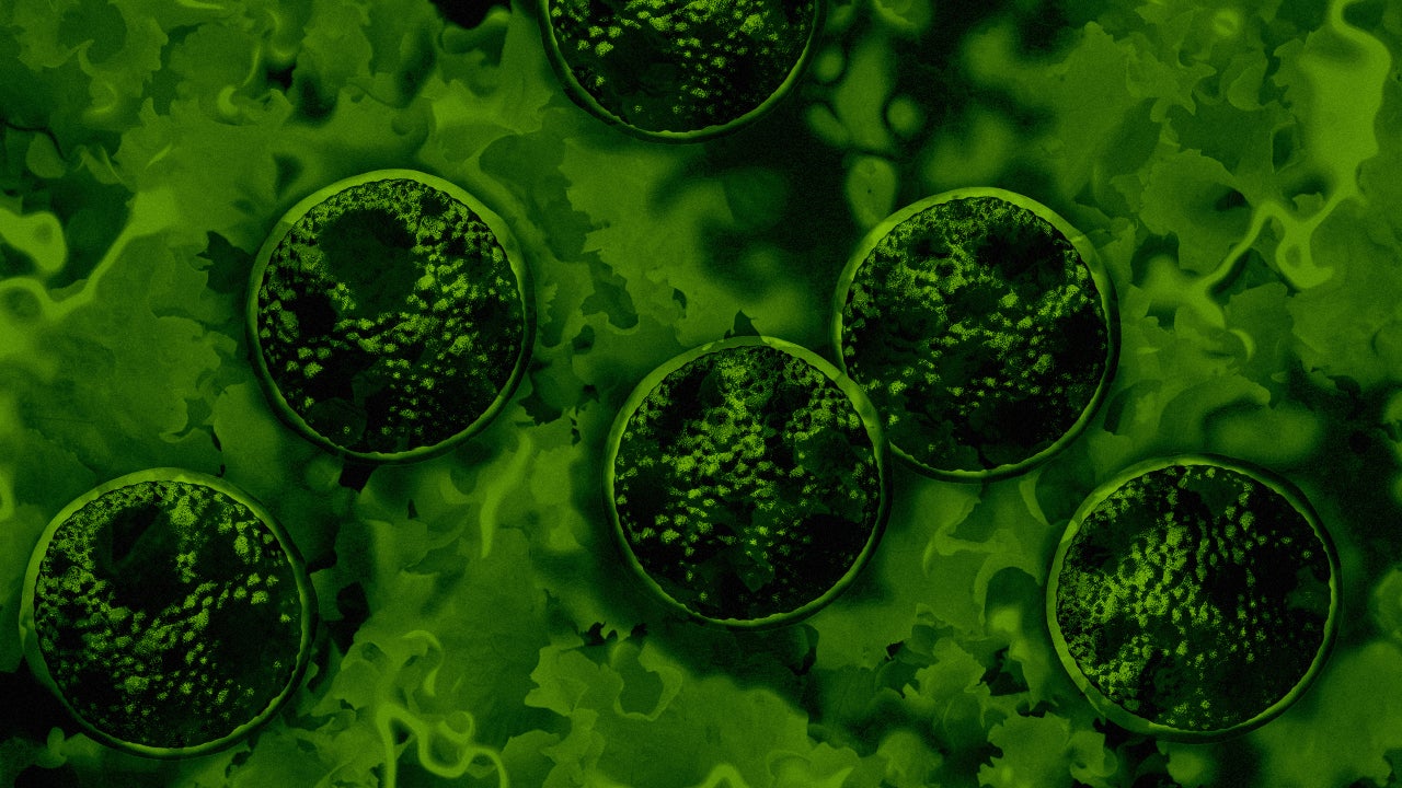 Cyclosporiasis update: CDC says parasite outbreak just spread to 4 new states. Full list of where to skip the lettuce