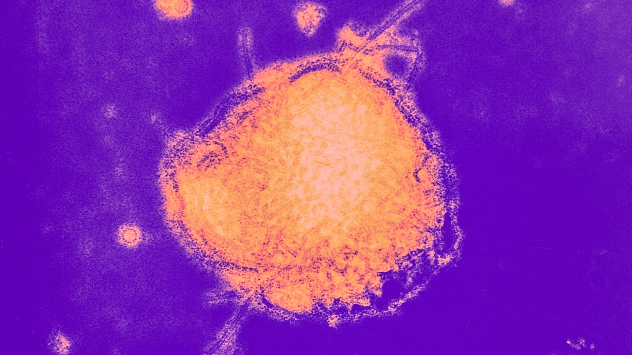 Measles outbreaks surge to top 3,500 cases this year: These tracker maps show the areas hardest hit
