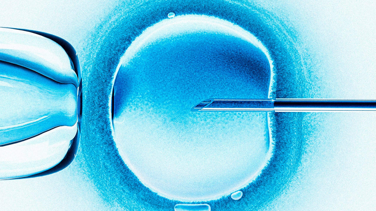 AI and IVF: A fertility doctor’s insight into the future of reproductive medicine