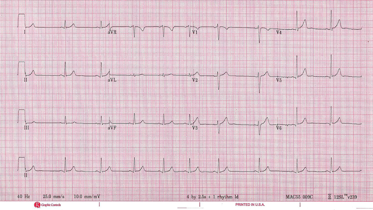 How Figure 1, The 