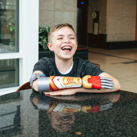 Colorful 3D‑printed prosthetic parts on a table