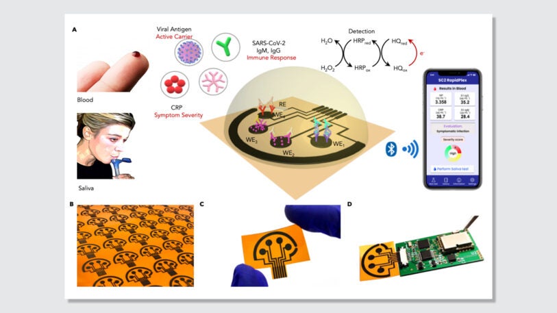 A 5-cent sensor could detect the coronavirus in 10 minutes at home ...