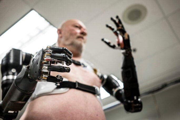 This startup is bringing the first mind-controlled prosthetic arm to ...