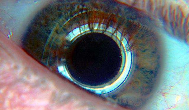 digital eye
