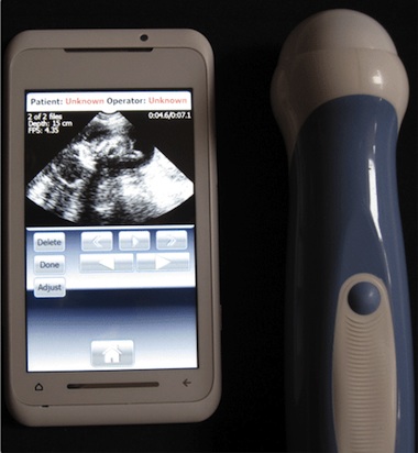 smartphone ultrasound