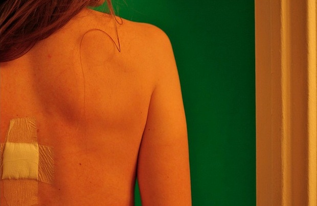 wound